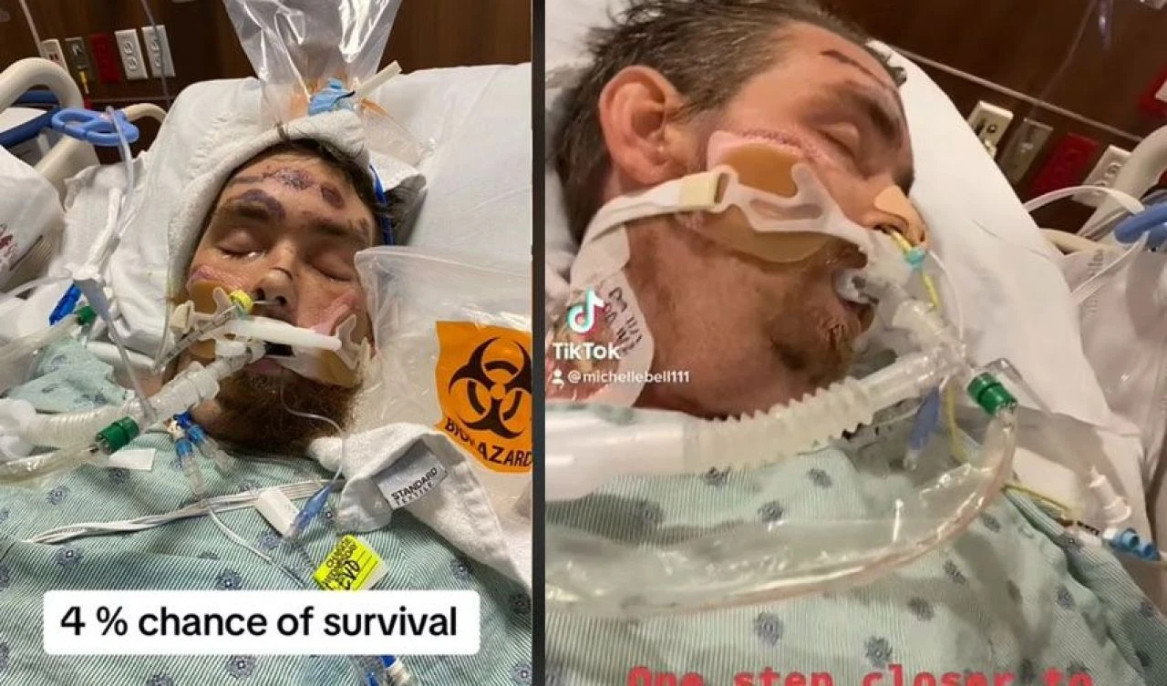 Kıl dönmesi komalık etti! Haftalar sonra kendi başına nefes alabildi - 1. Resim