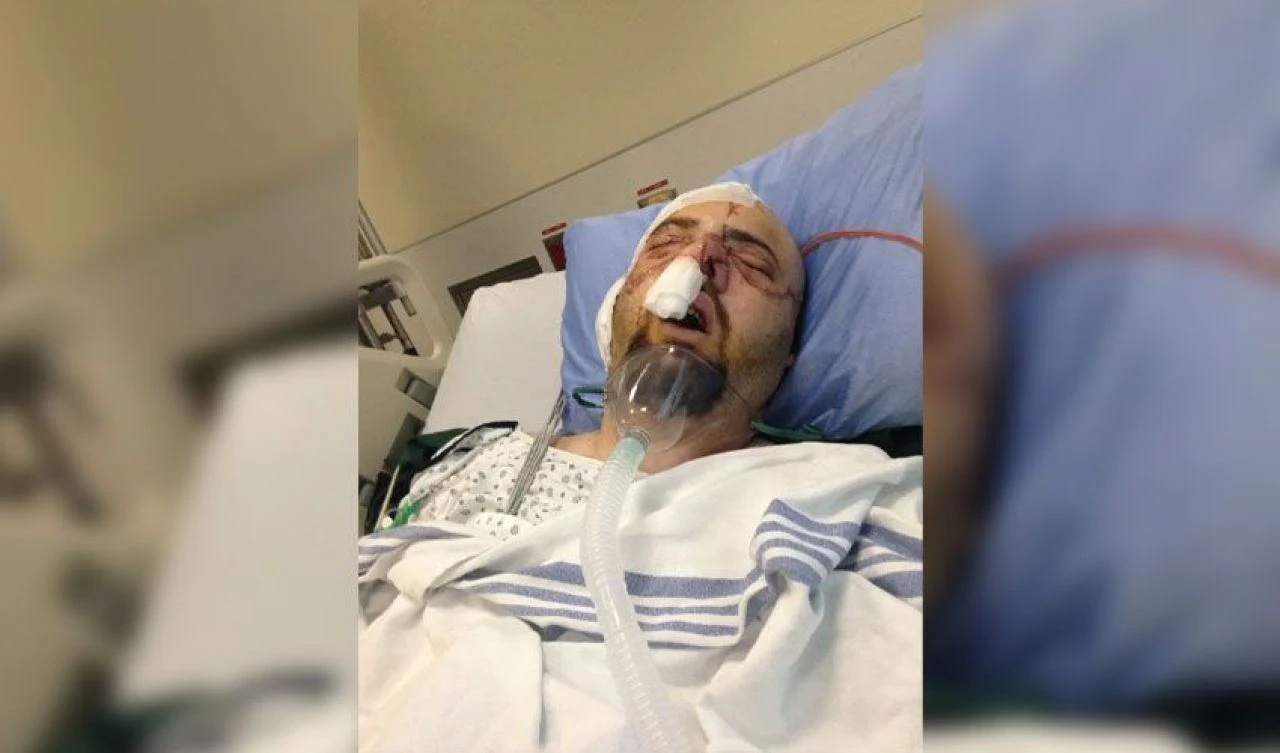 Ava giderken ayı tarafından avlandı! Yüzü paramparça kilometrelerce yol katetti - 2. Resim