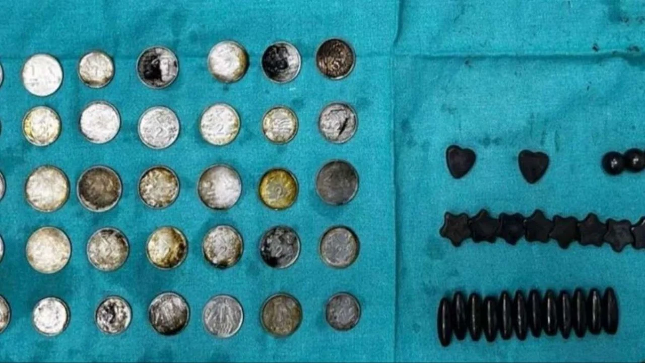 Çinko takviyesini yanlış anladı! Midesinden çıkanlar 'yok artık' dedirtti