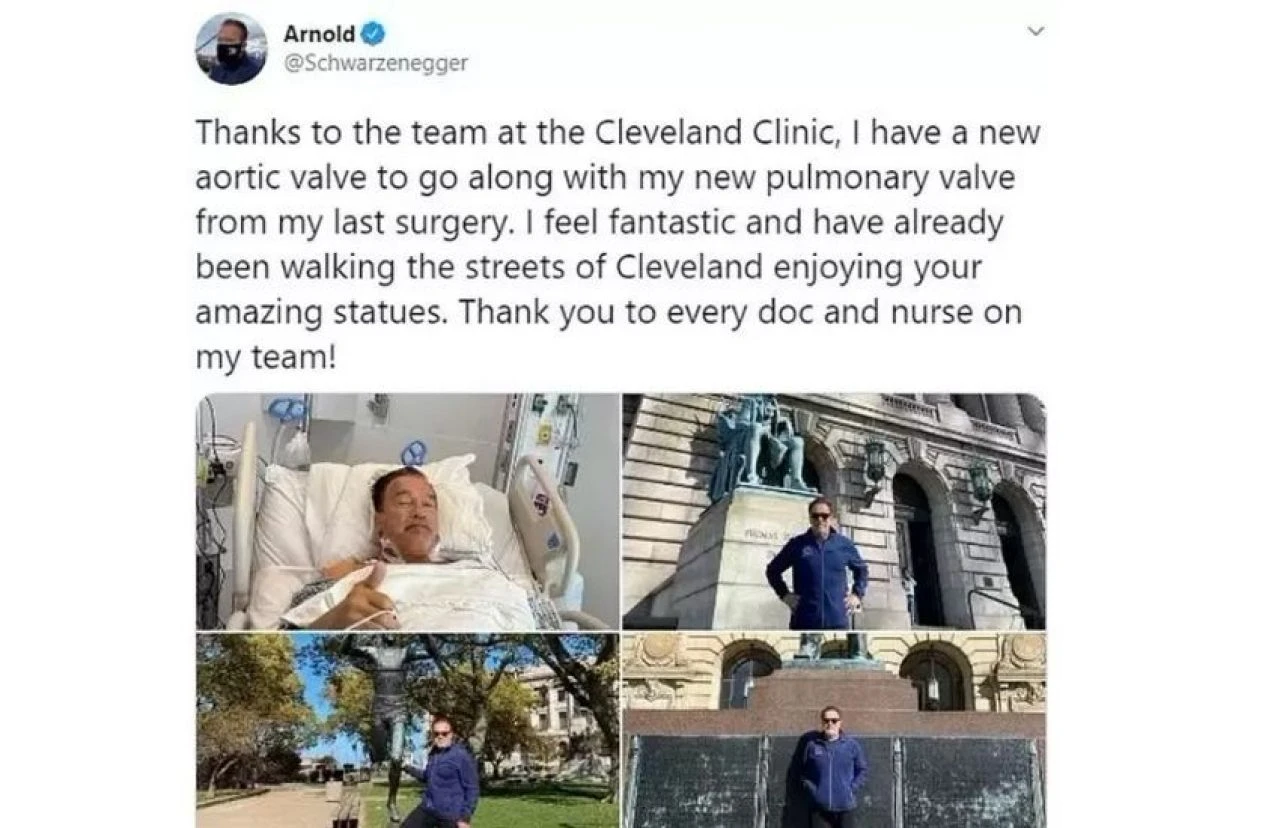 Terminatör serisinin yıldızı üç kalp ameliyatı geçirdi: Artık tam bir makineyim!