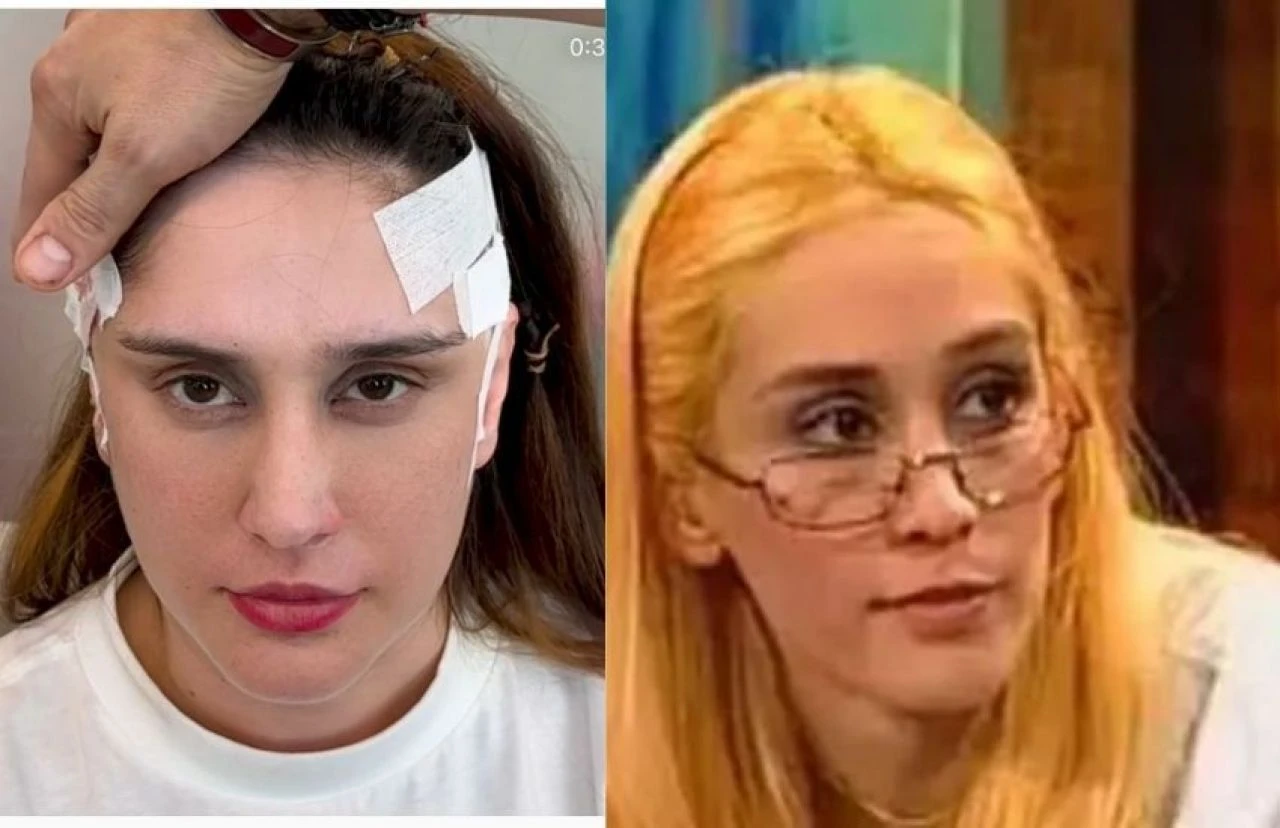 ÇGHB'nin yıldızı Zeynep Koçak'ın estetik işlemleri sırasında çekilen karesi sosyal medyada ilgi gördü