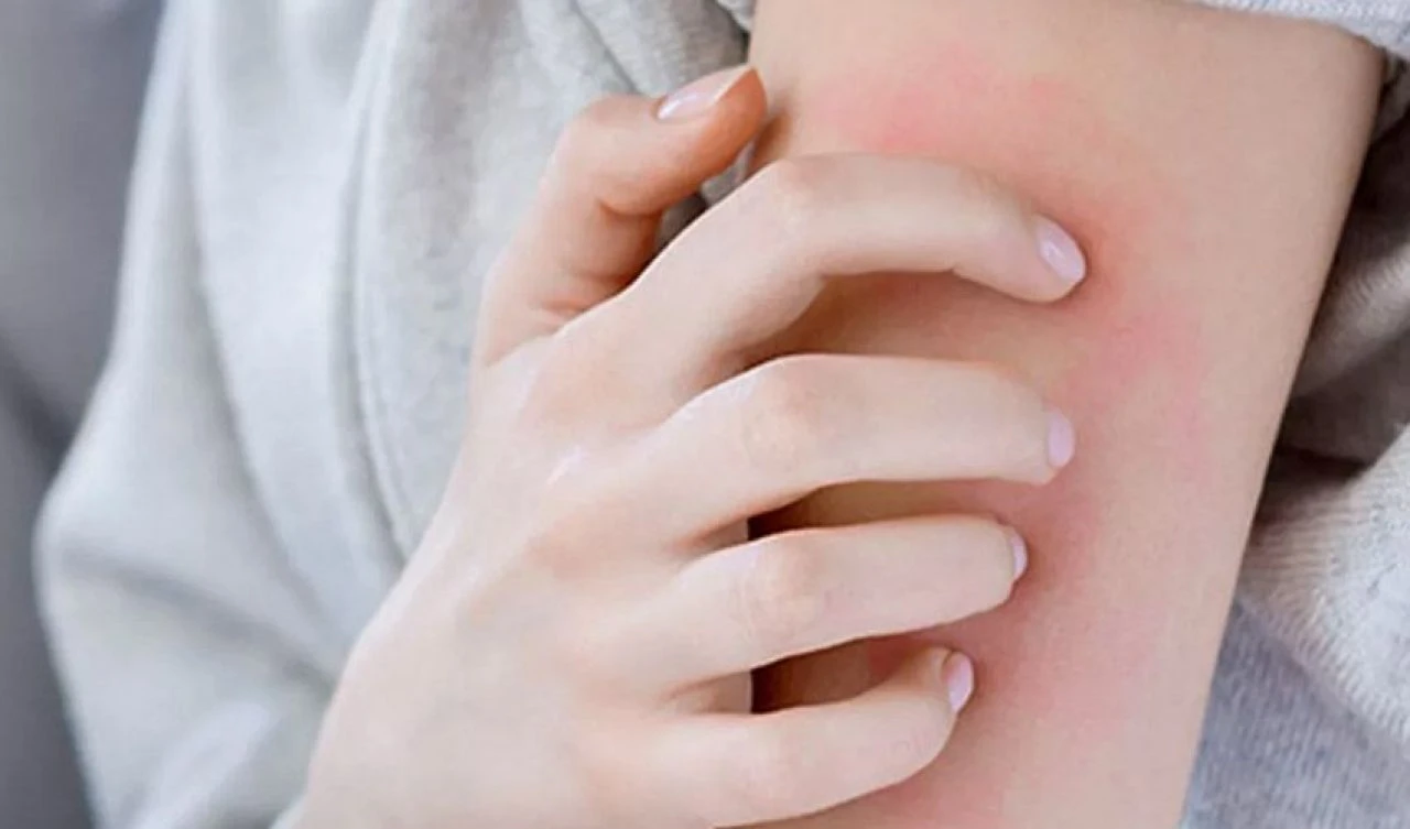 Bu hastalığa siz de yakalanmış olabilirsiniz! El, koltuk altı, bel, kalça, ayak kaşıntılarına dikkat! - 1. Resim