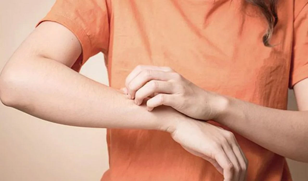 Bu hastalığa siz de yakalanmış olabilirsiniz! El, koltuk altı, bel, kalça, ayak kaşıntılarına dikkat! - 2. Resim