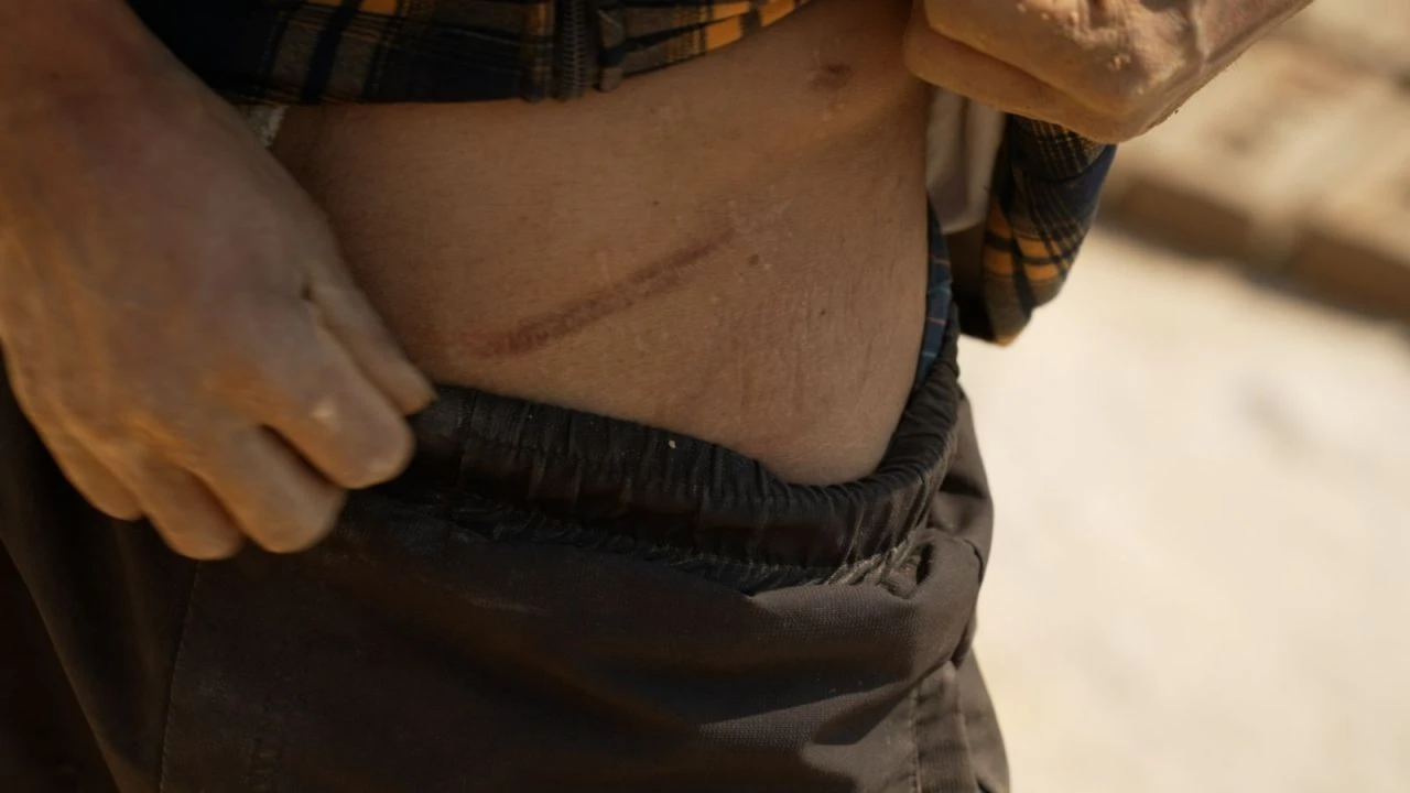 Bu köyde neredeyse herkes böbreğini sattı!