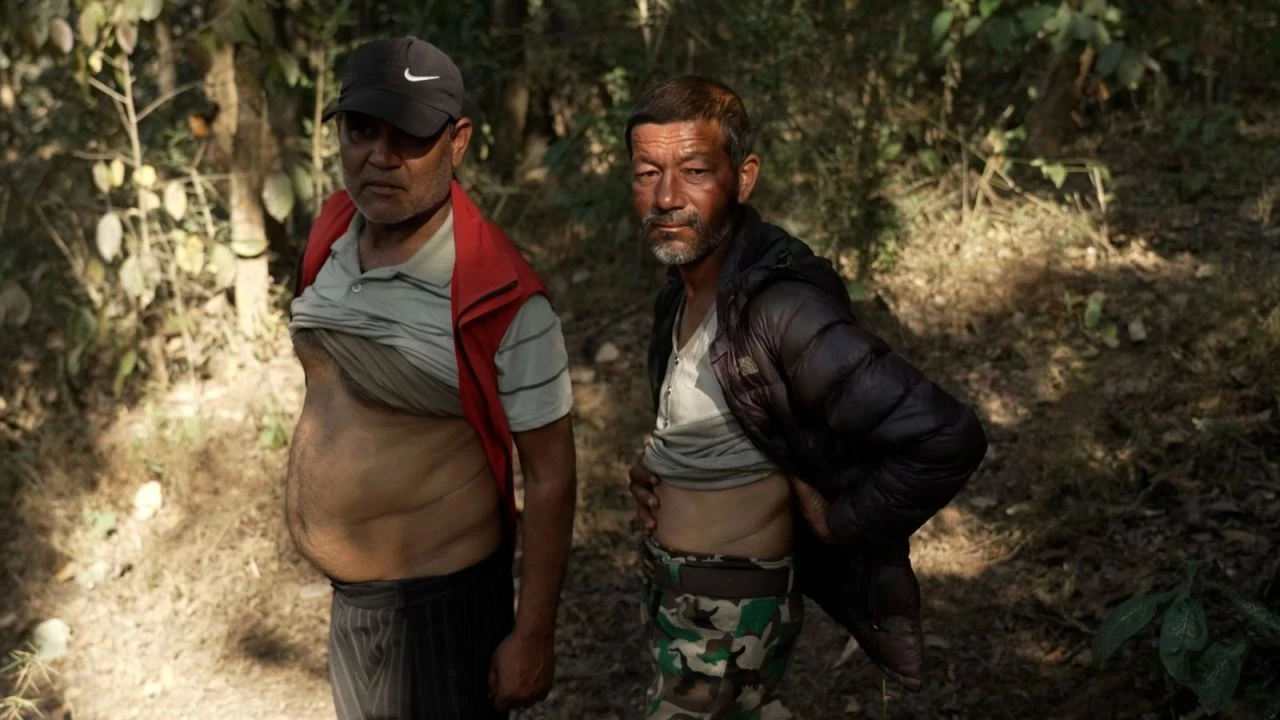 Bu köyde neredeyse herkes böbreğini sattı!