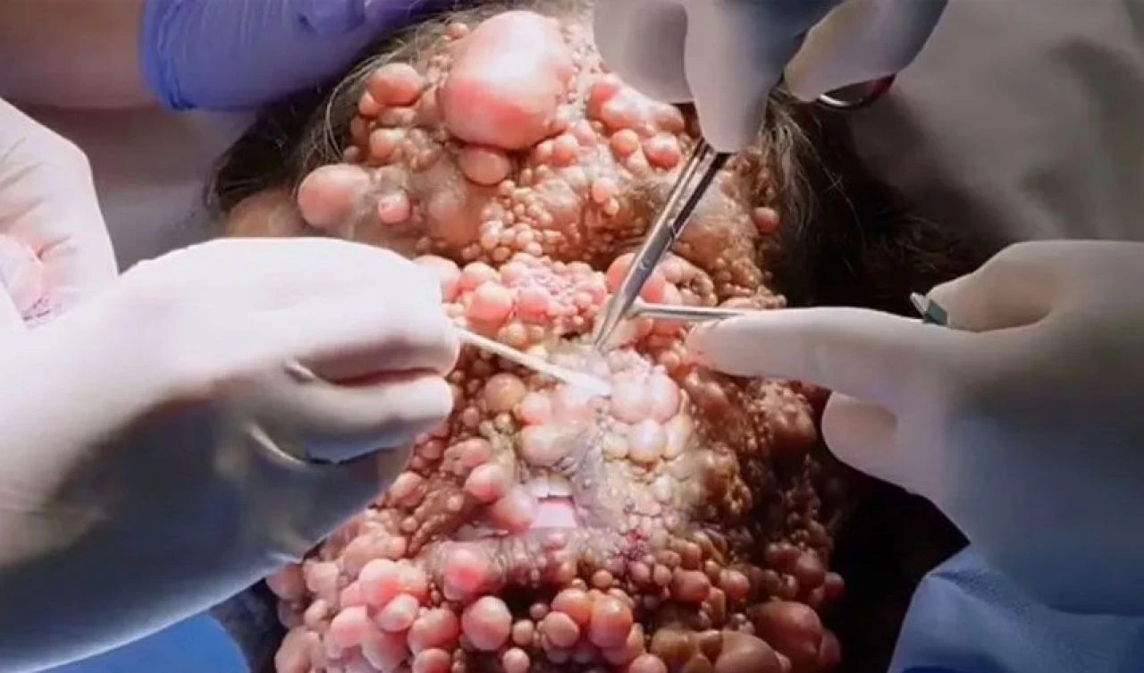 Türünün tek örneği! Yalnız ölmekten korkuyor - 4. Resim