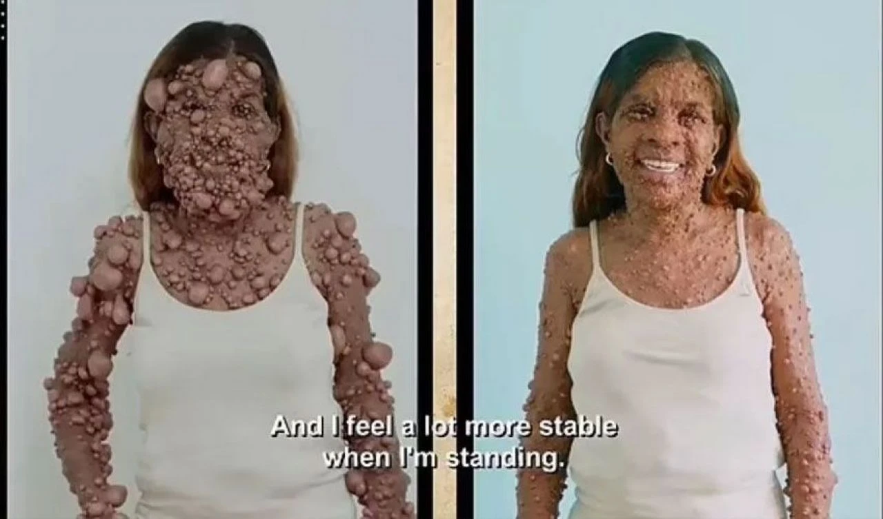 Türünün tek örneği! Yalnız ölmekten korkuyor - 5. Resim