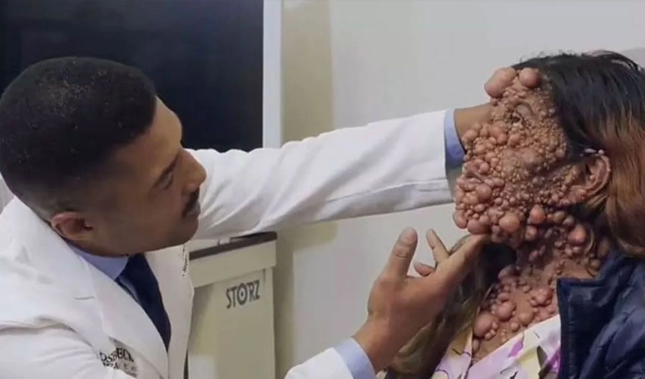 Türünün tek örneği! Yalnız ölmekten korkuyor - 2. Resim