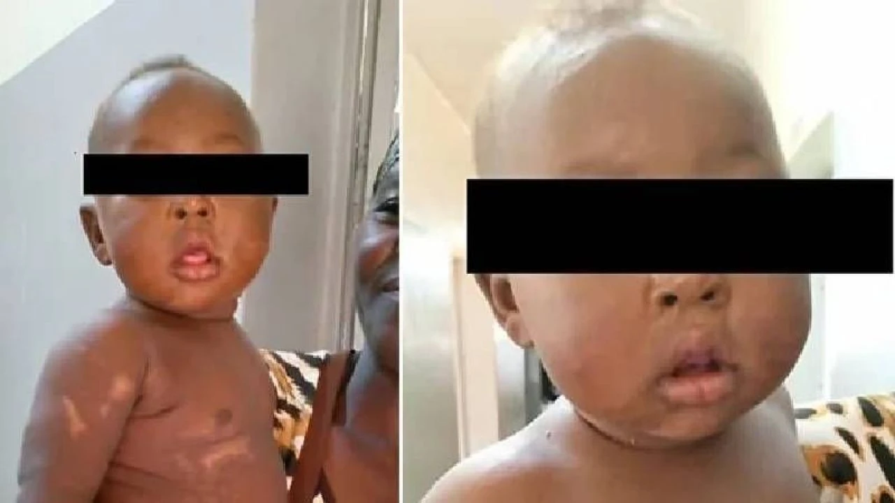 Bebeğini diri diri toprağa gömdü aile üyeleri şans eseri kurtardı - 1. Resim