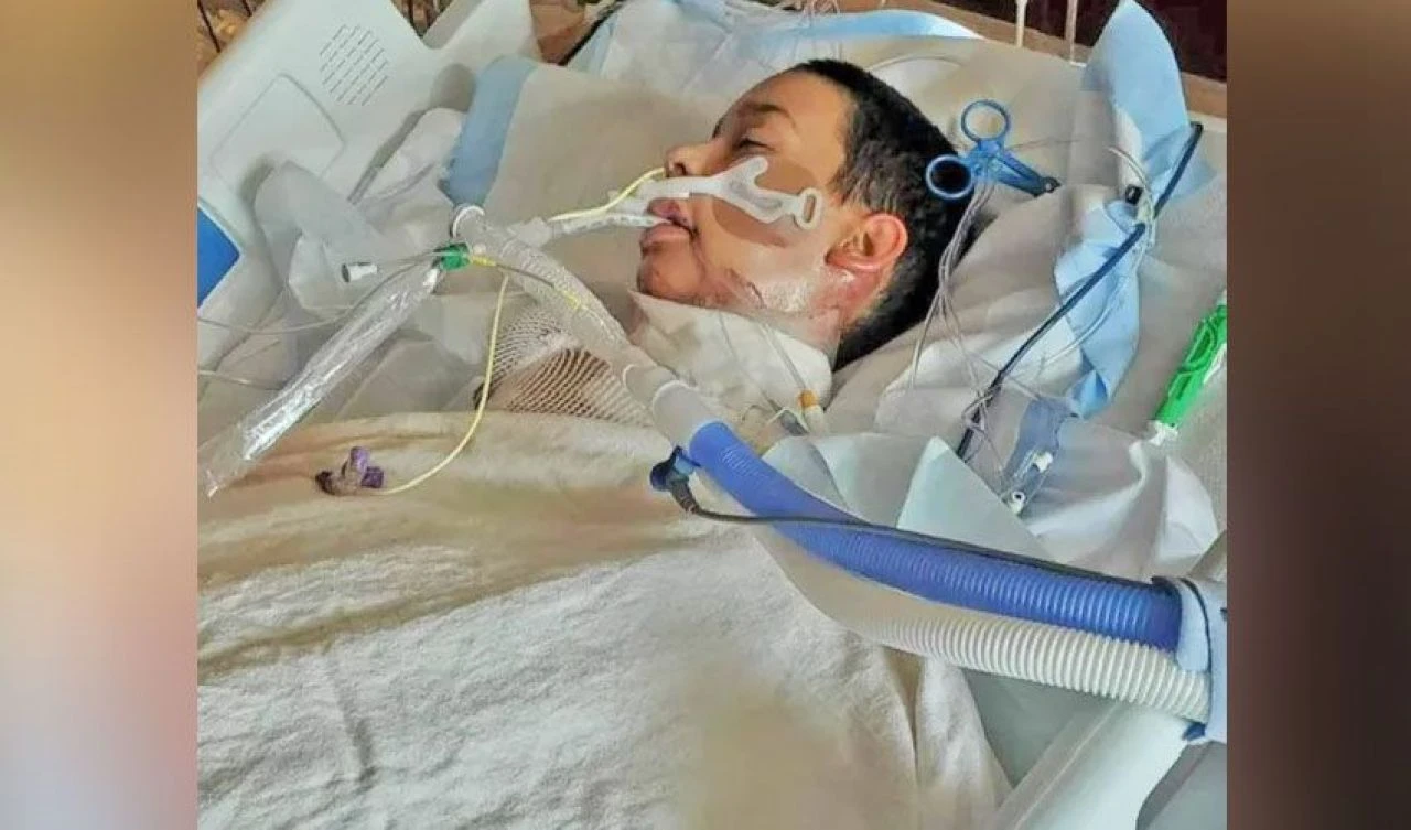 TikTok'taki akım çocuğu ateş topuna çevirdi! Tehlikeli trend ölümüne sebep oluyordu - 1. Resim