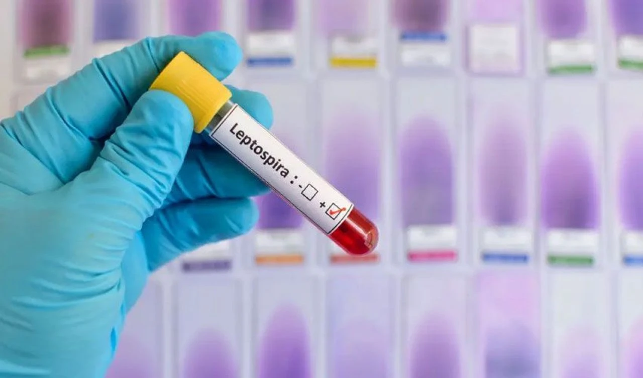 Tuvalet faresi tarafından ısırıldı, başına gelmeyen kalmadı - 2. Resim