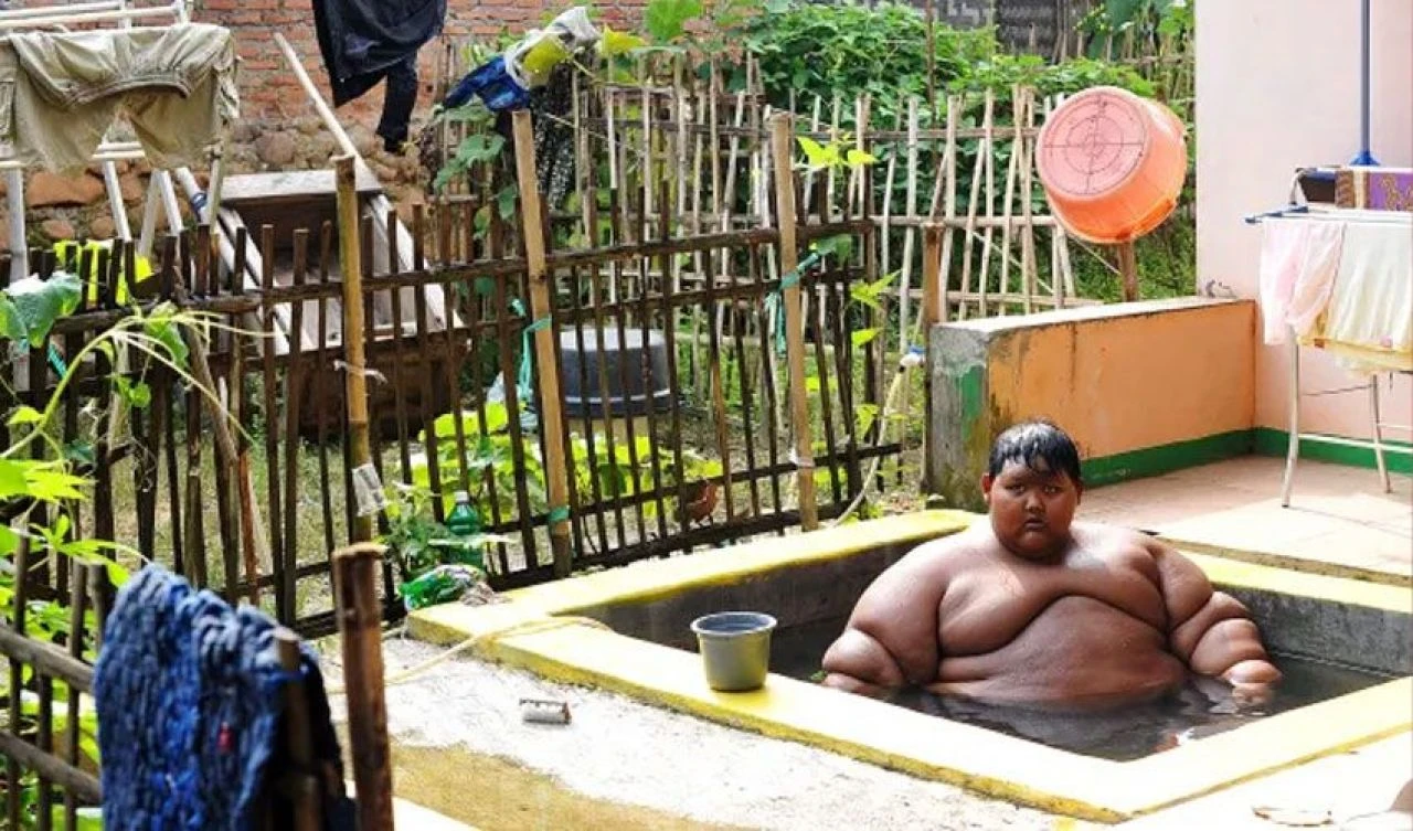 Dünyanın en şişman çocuğuydu! Şimdi tanınmaz halde