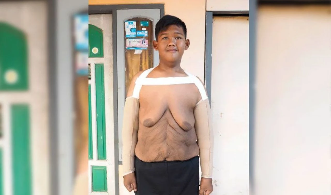 Dünyanın en şişman çocuğuydu! Şimdi tanınmaz halde