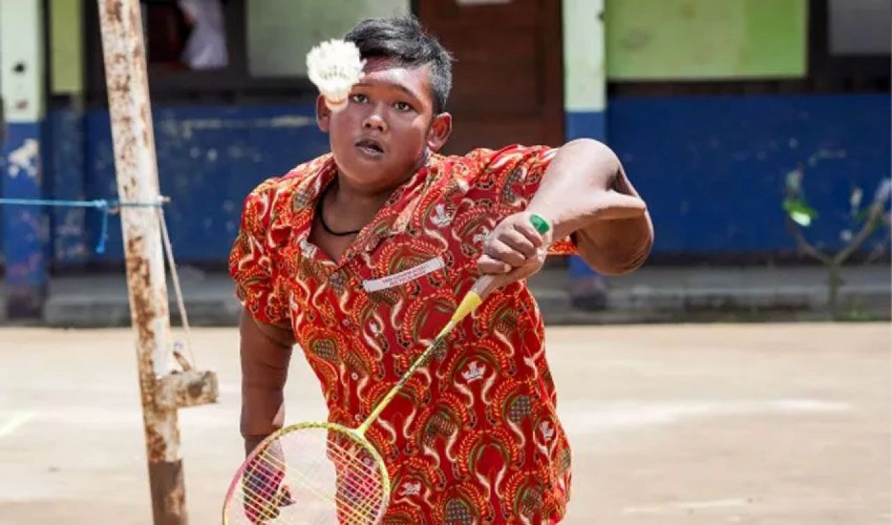 Dünyanın en şişman çocuğuydu! Şimdi tanınmaz halde