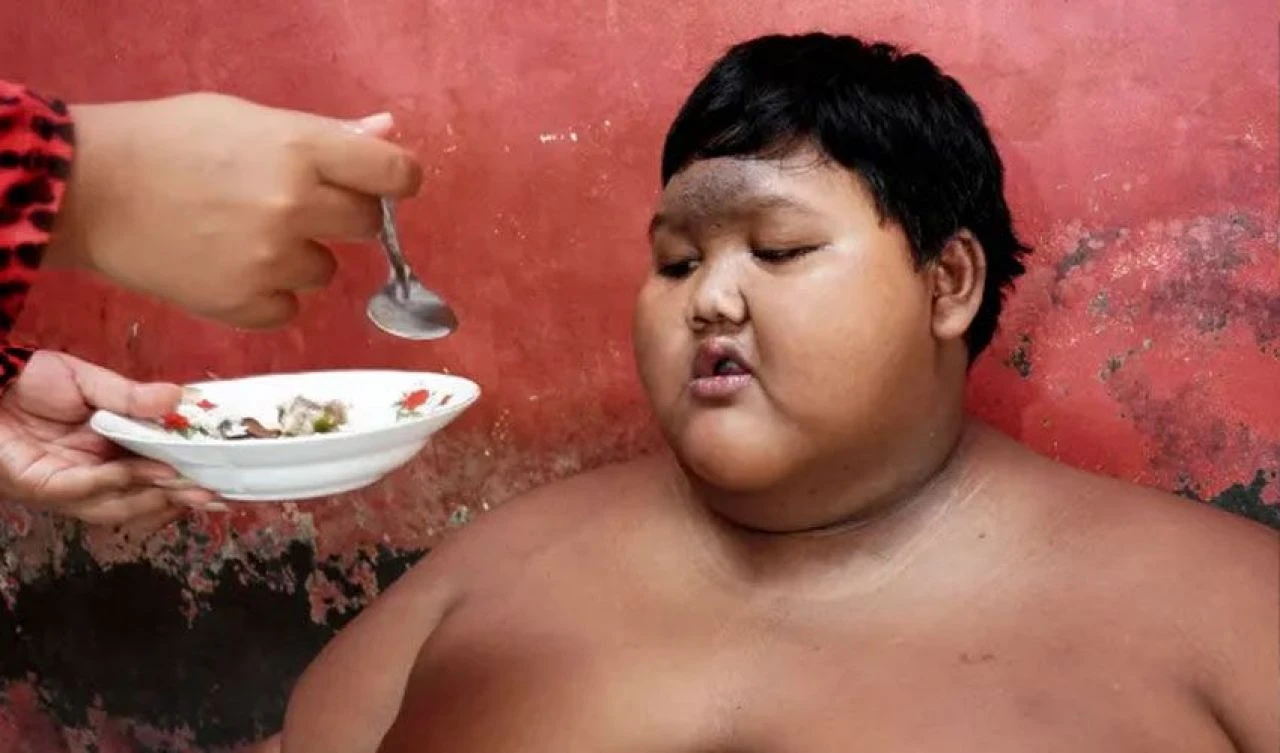 Dünyanın en şişman çocuğuydu! Şimdi tanınmaz halde