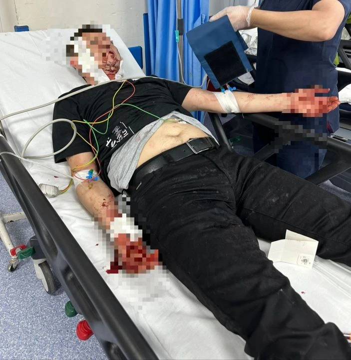 Köpek dehşeti kamerada: Adamı saniyeler içinde parçaladılar - 1. Resim