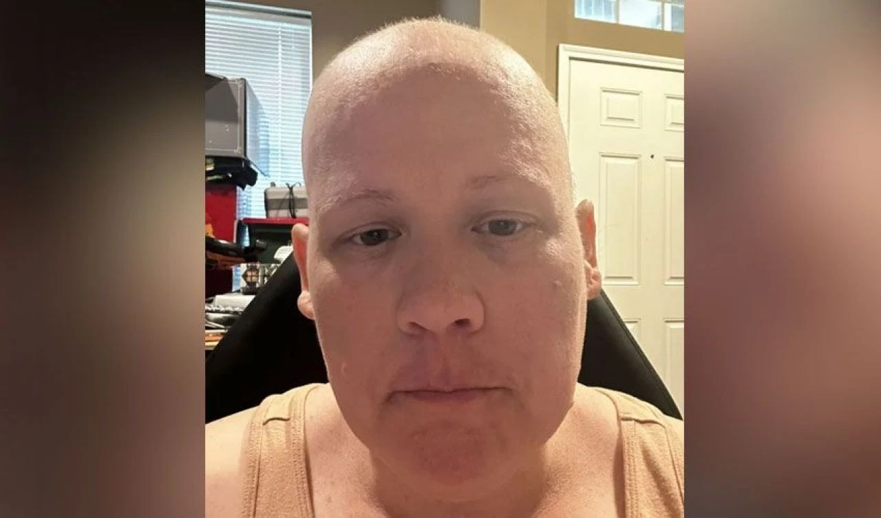 15 ay ömrü kaldığı söylendi, kemoterapi gördü, saçı döküldü... Skandal ihmal az kalsın öldürüyordu - 3. Resim