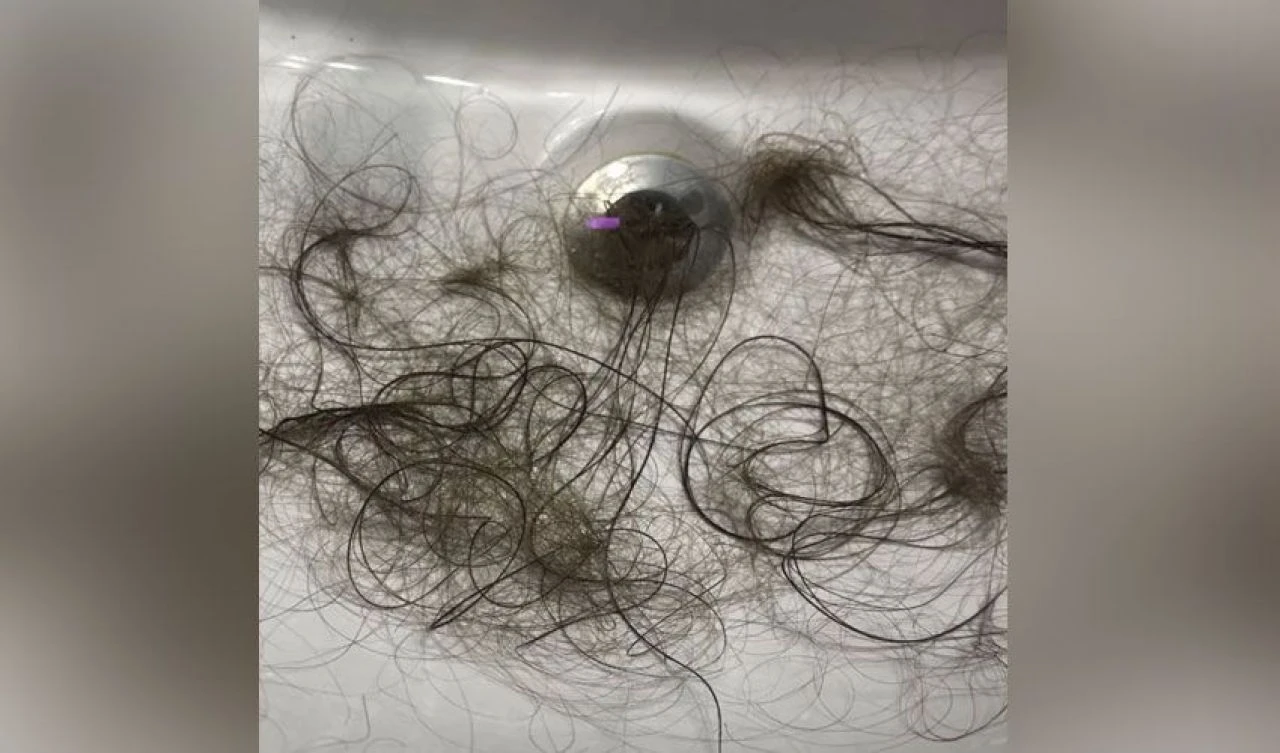 15 ay ömrü kaldığı söylendi, kemoterapi gördü, saçı döküldü... Skandal ihmal az kalsın öldürüyordu - 2. Resim