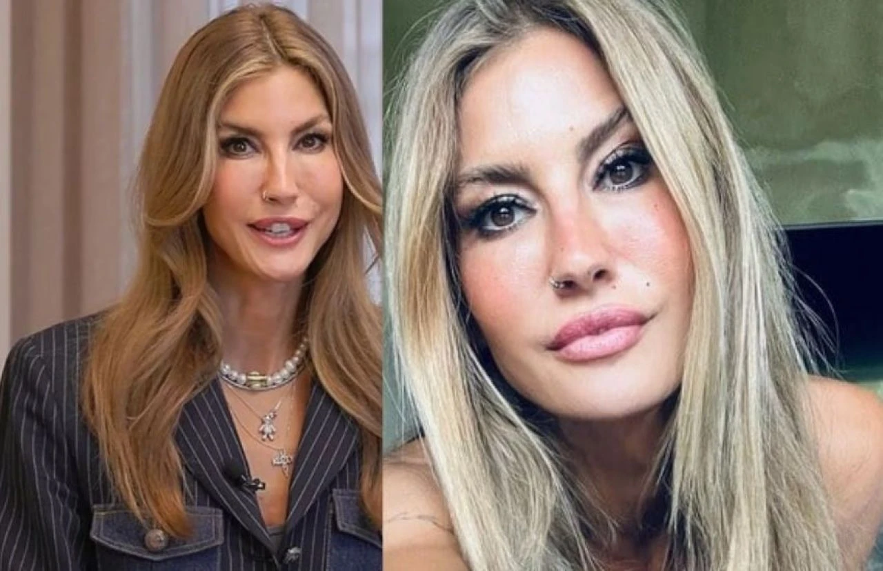 Estetiğin dozunu kaçıran Çağla Şıkel tanınmaz halde! Takipçilerinden geçer not alamadı