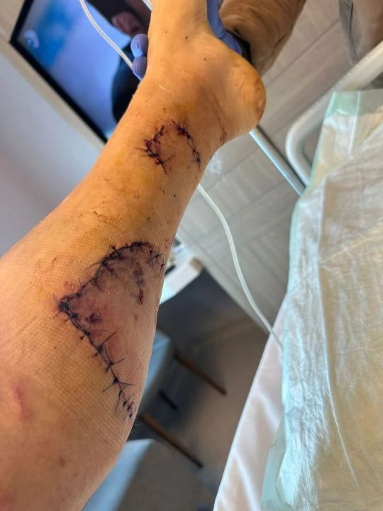 Sahibini kıskanan Çin Aslanı dehşet saçtı! Genç kadının bacağını paramparça etti - 1. Resim