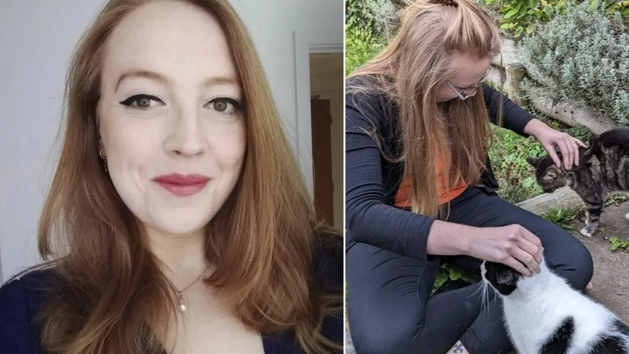 Her şeye alerjisi var! Sadece 4 yiyecekle beslenebiliyor... - 2. Resim