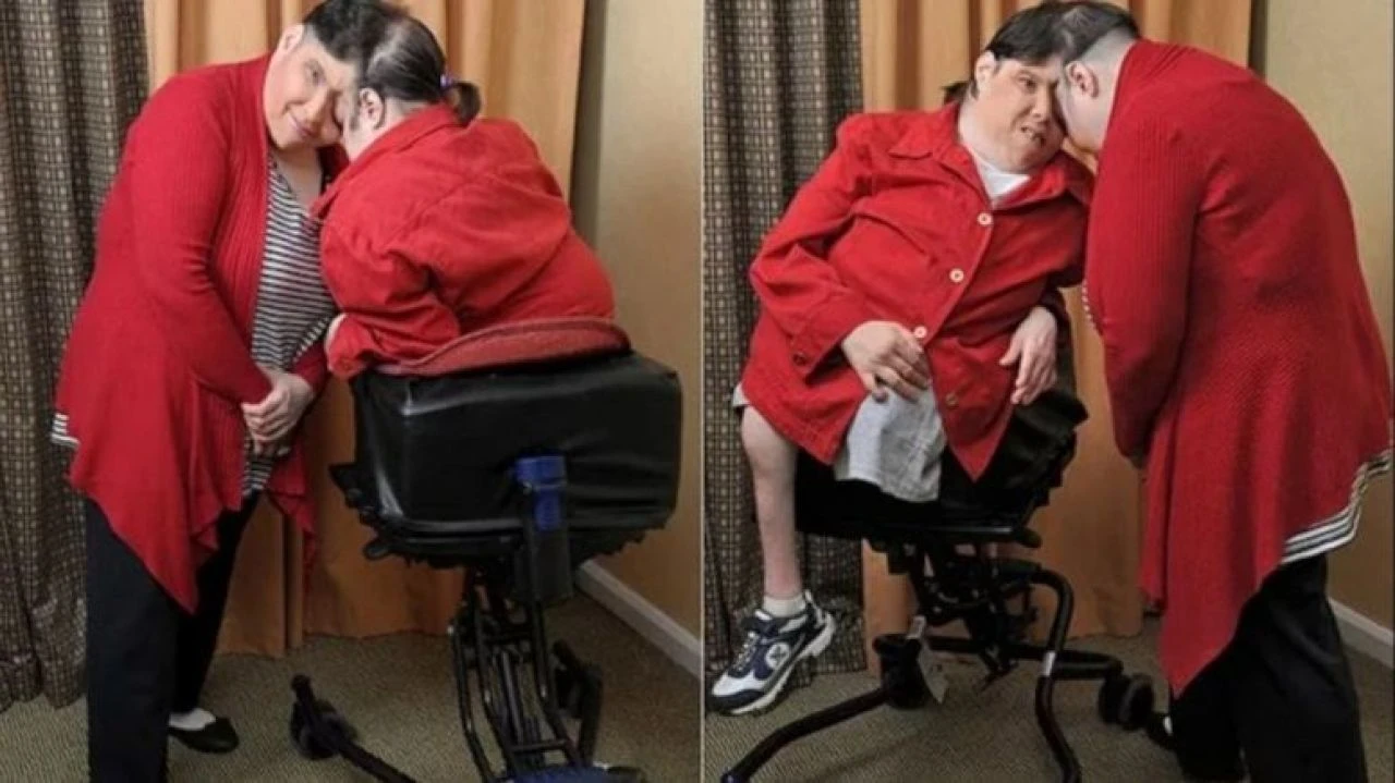 Dünyanın en yaşlı yapışık ikizleri hayatlarını kaybetti - 1. Resim