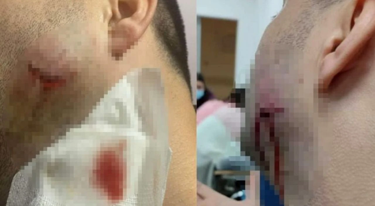Sağlıkçılara saldıran uzman çavuş görevden alındı  - 1. Resim