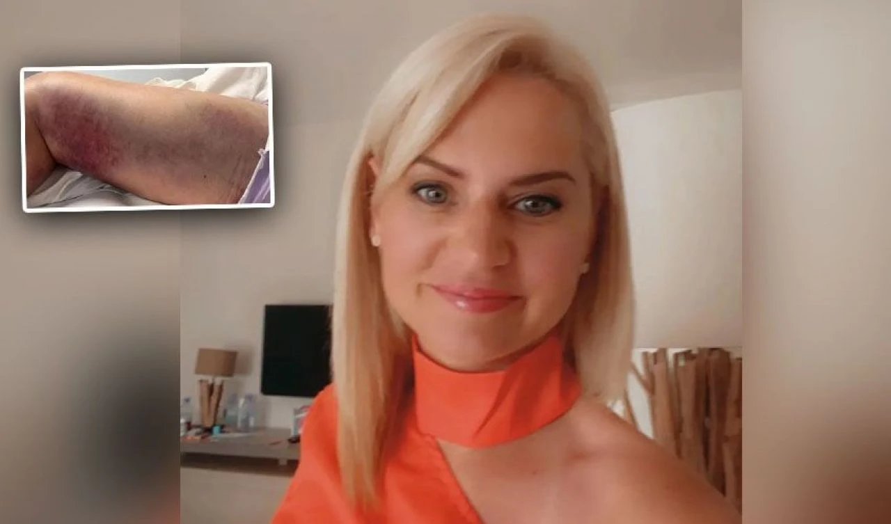 Tek ısırığıyla ölüm kalım savaşı verdi! Ünlü tatil bölgesinde engerek yılanı paniği - 2. Resim