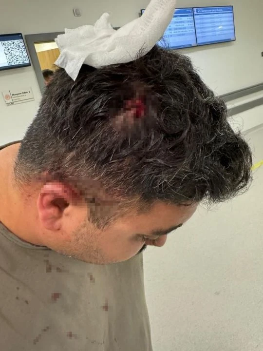 Milli boksör bekçiyi böyle dövdü: Sopayla kafasına vurdu - 2. Resim