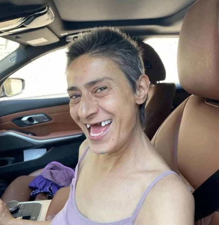 Yıldız Tilbe son haliyle görenleri şaşkına çevirdi!  - 2. Resim