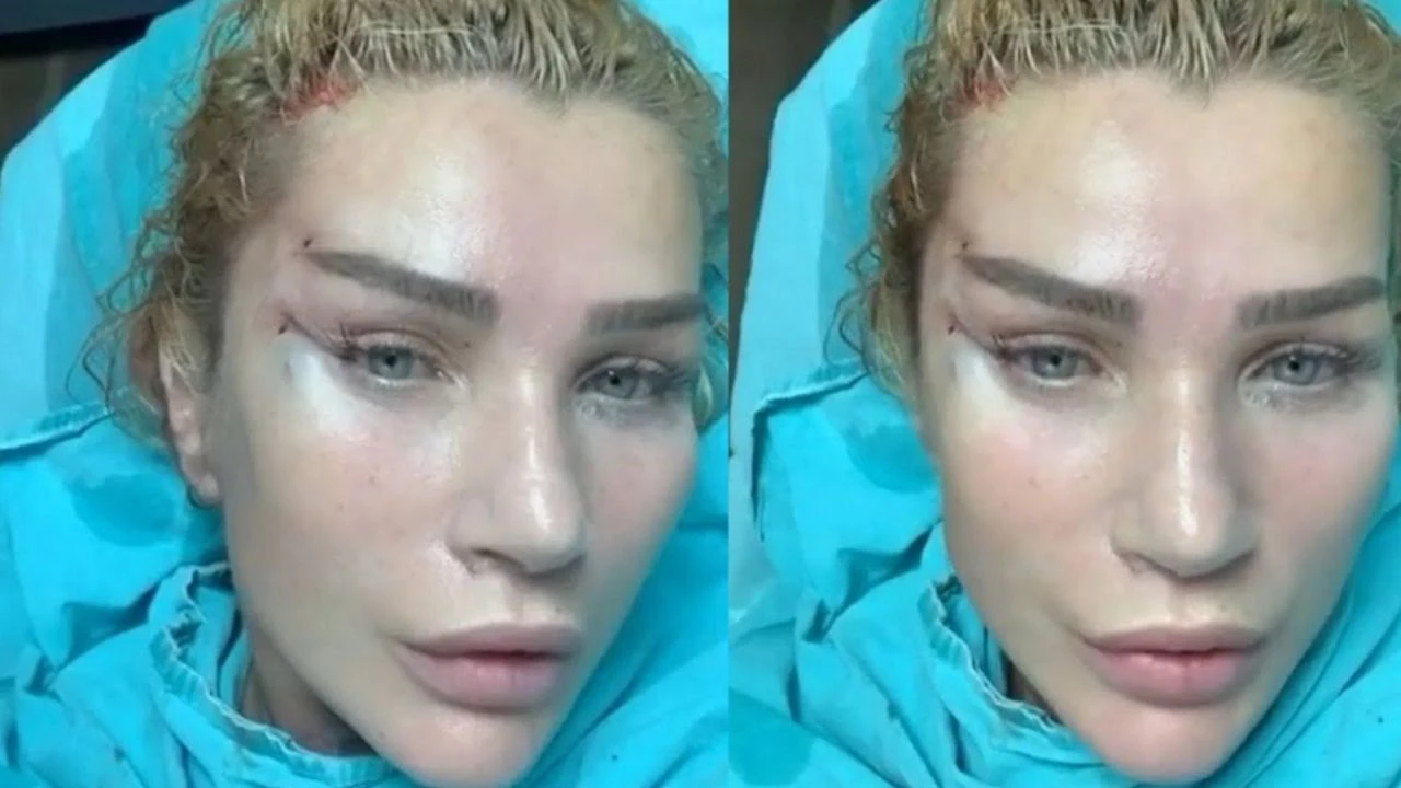 Sertap Erener Estetikle Seda Sayan oldu! Pes dedirten operasyon - 2. Resim