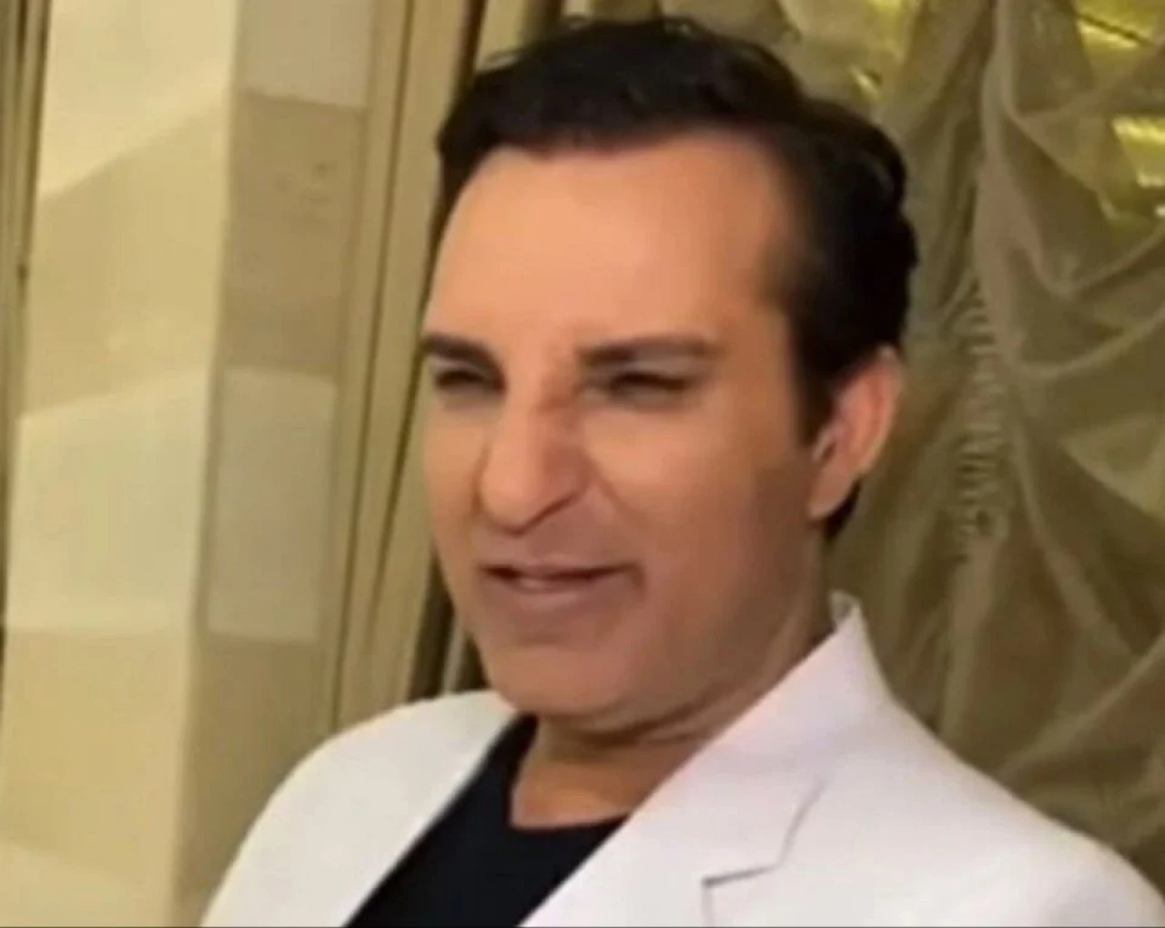 Mahmut Tuncer'de estetik furyasına katıldı! Görenler inanamadı - 2. Resim