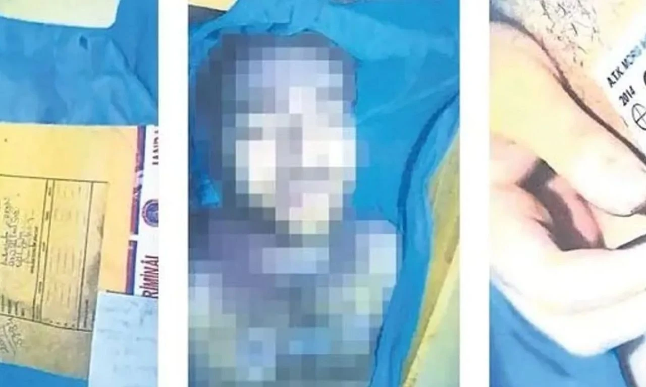 Otopsi görüntülerinde fark edildi! Cem Garipoğlu'nun elindeki morlukların sırrı çözüldü - 1. Resim