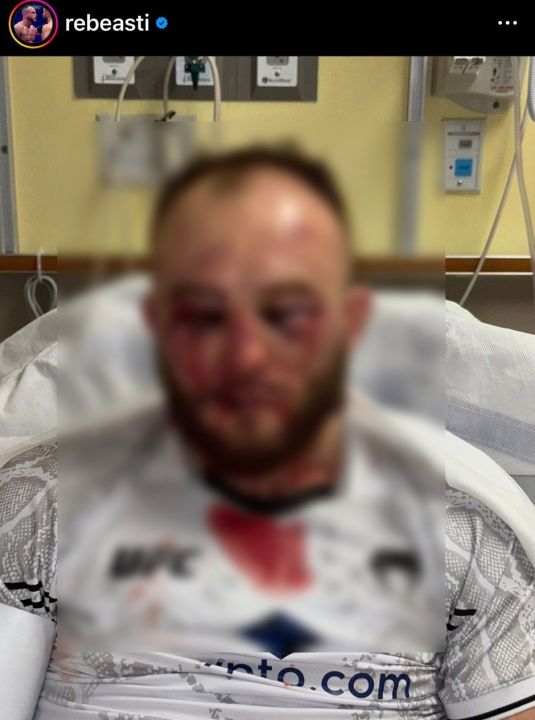 UFC yıldızını tanınmaz hale sokan nakavt: Hastanedeki son hali paylaşıldı - 1. Resim