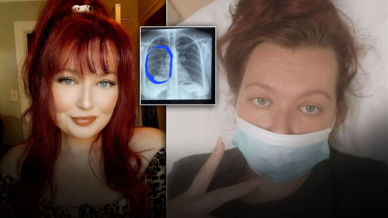 Elektronik sigara içen kadının &#039;ciğerleri kızarmış tavuk gibi patladı&#039;