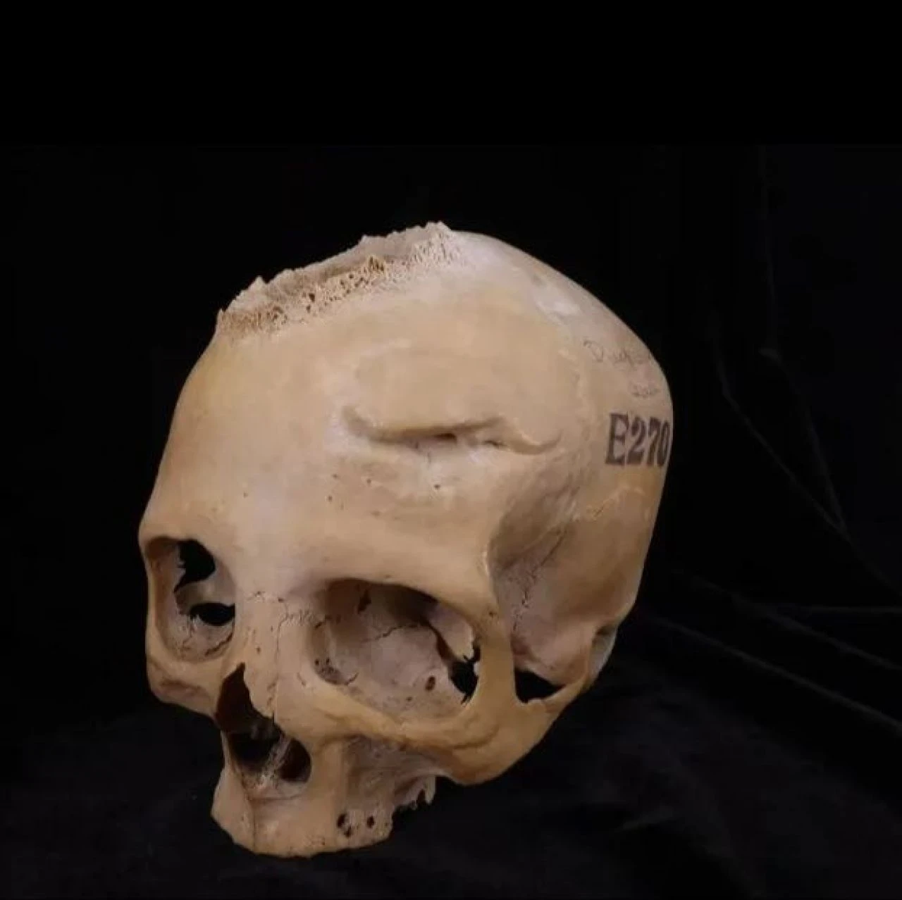 Antik Mısır'da beyin tümörü ameliyatı! 4 bin yıl önce kansere çözüm aradılar - 4. Resim