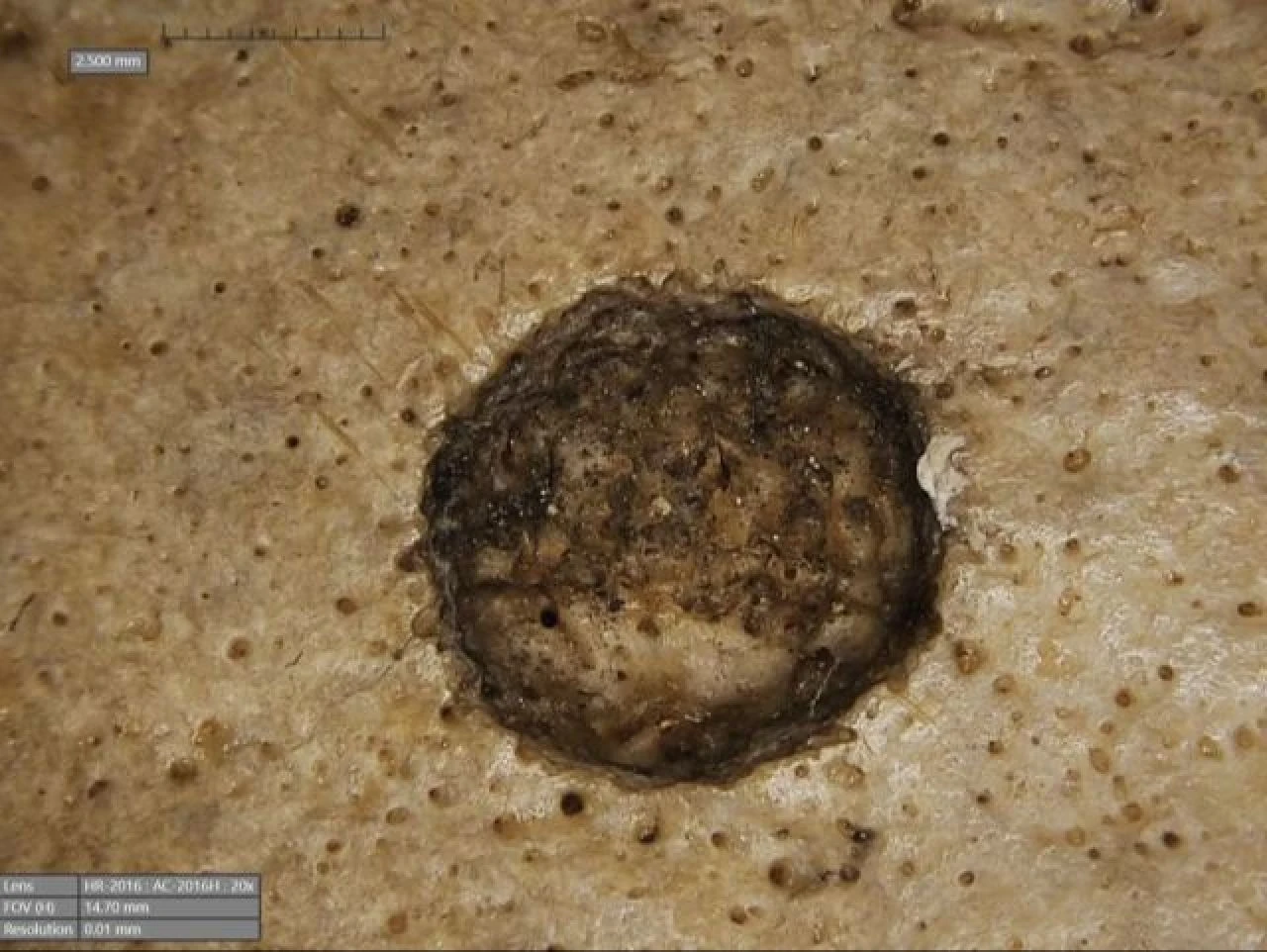 Antik Mısır'da beyin tümörü ameliyatı! 4 bin yıl önce kansere çözüm aradılar - 2. Resim