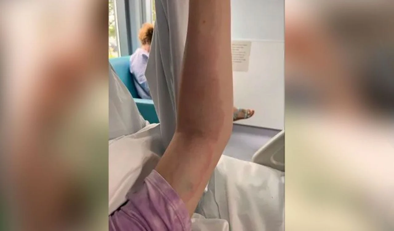 Engerek yılanı ısırdı organları iflas etmeye başladı! Az kalsın 20 dakika içinde ölüyordu - 1. Resim