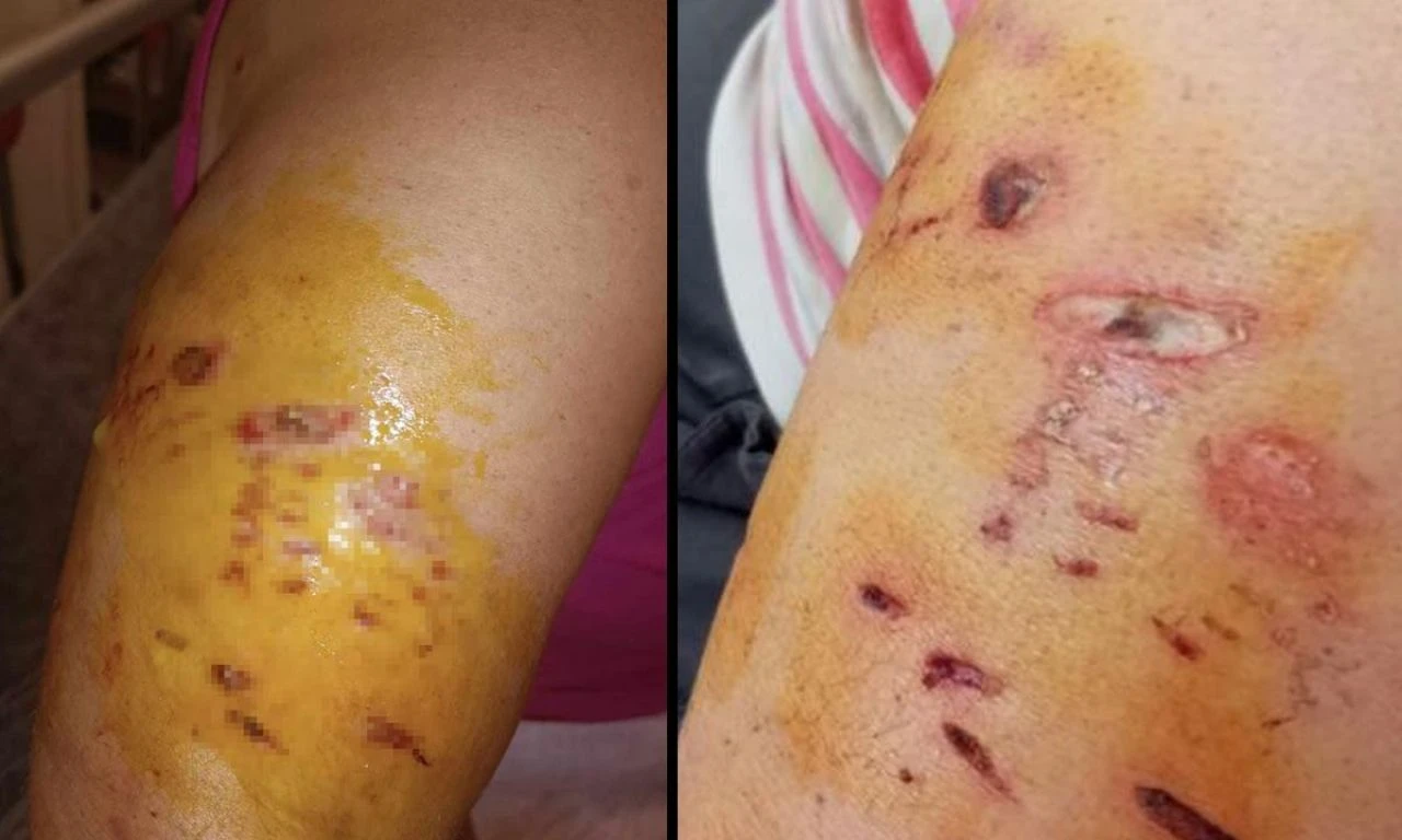 Köpekler dehşeti yaşattı, artık evden çıkamıyor!