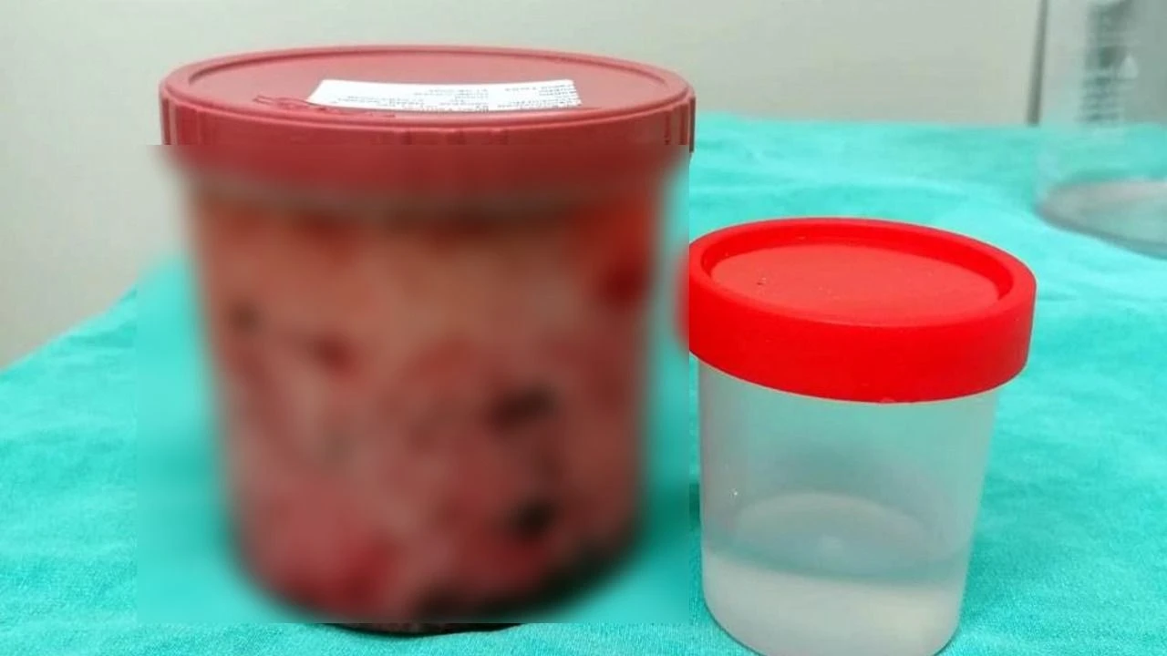 22 yıllık doktor bile hayretler içinde kaldı! Tıp tarihinde nadiren görülüyor - 3. Resim