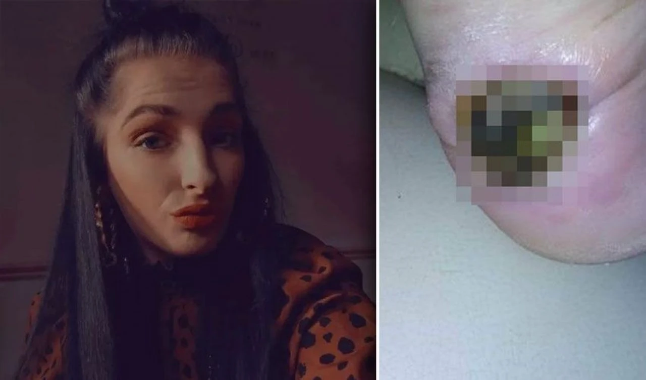 Ayağına vuran ayakkabı yüzünden bacağından oldu! Diz üstünden kesildi