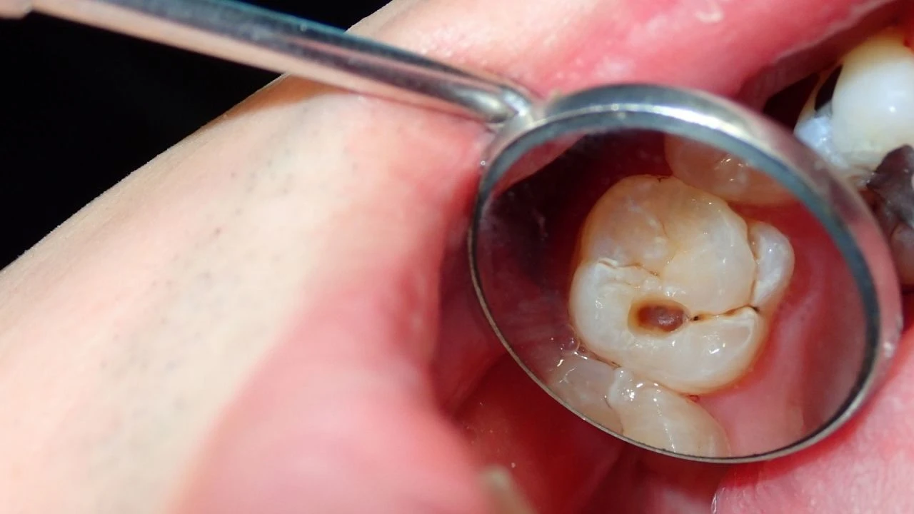 Sıcak havaların gözdesi dondurma kabusa dönüyor! Dişleri çürütüyor, kalp krizini tetikliyor - 2. Resim