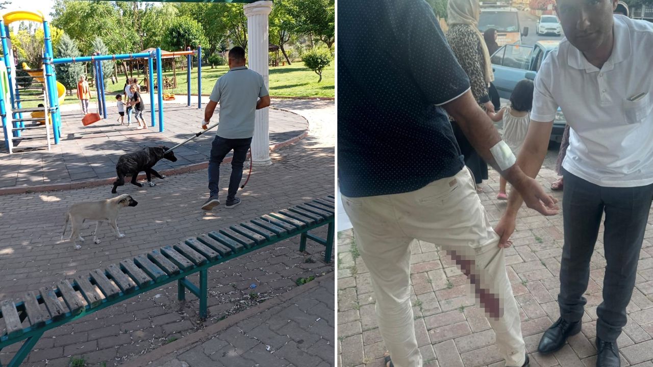 Yolda yürürken bir anda ısırdı! Saldırgan sokak köpeği kuduz çıktı