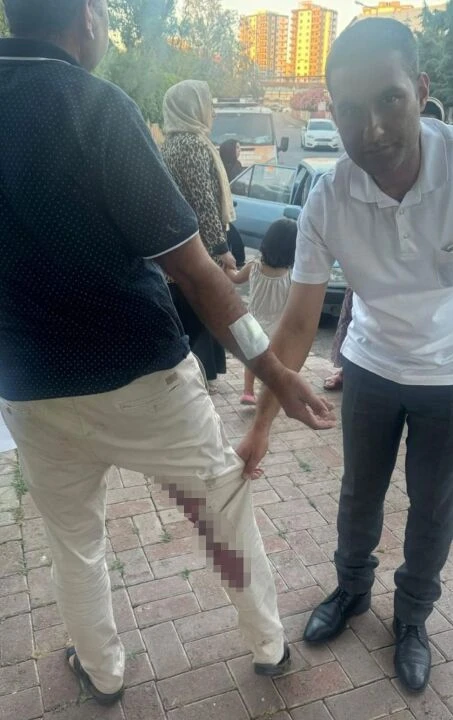 Yolda yürürken bir anda ısırdı! Saldırgan sokak köpeği kuduz çıktı - 2. Resim