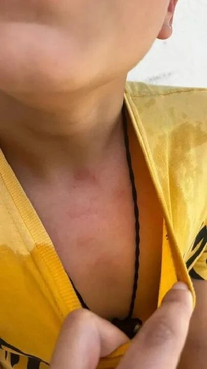 Bu nasıl vicdansız öğretmen! Öğrencisini kaynar suyla haşladı - 1. Resim