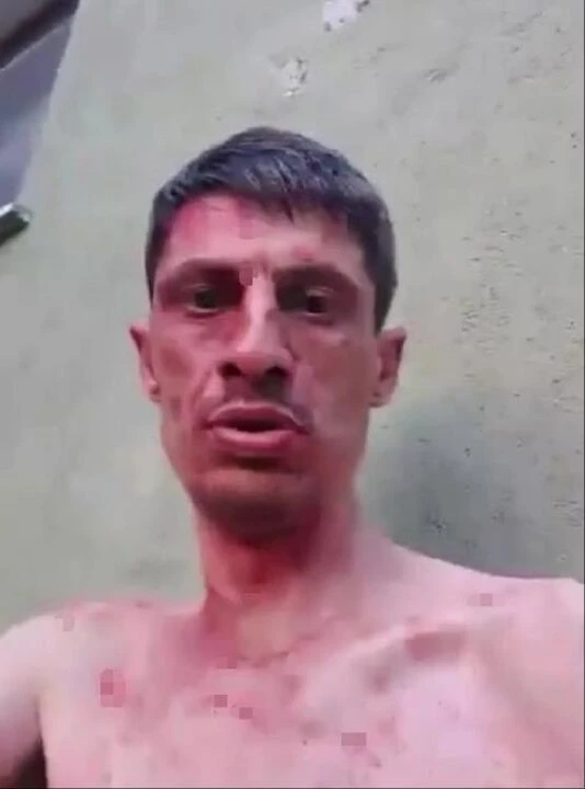 Canlı yayında eniştesini bıçakladı! Kan donduran görüntüler gündem oldu