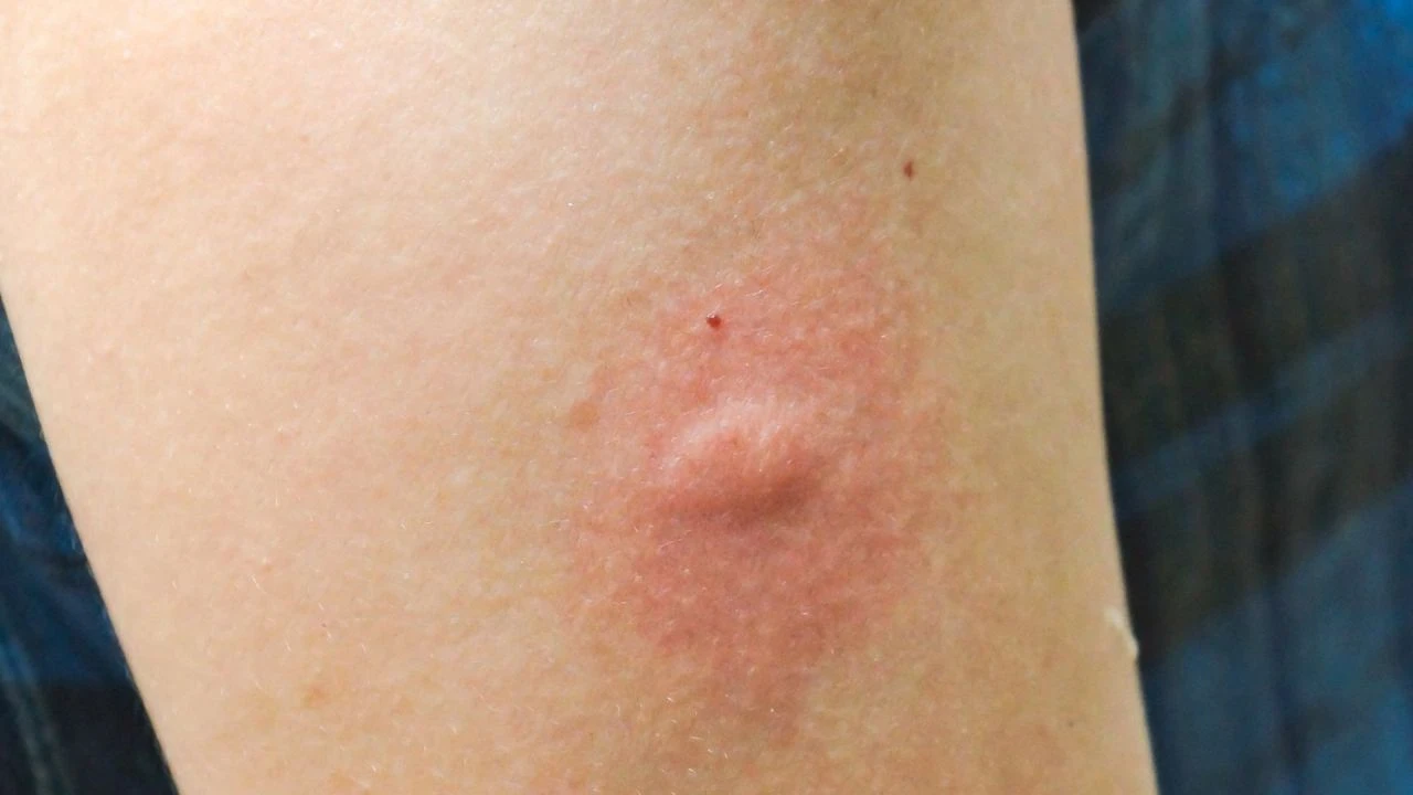 Batıda sinek, Doğuda çekirge alarmı verildi! Evlerin içlerine kadar giriyorlar - 4. Resim