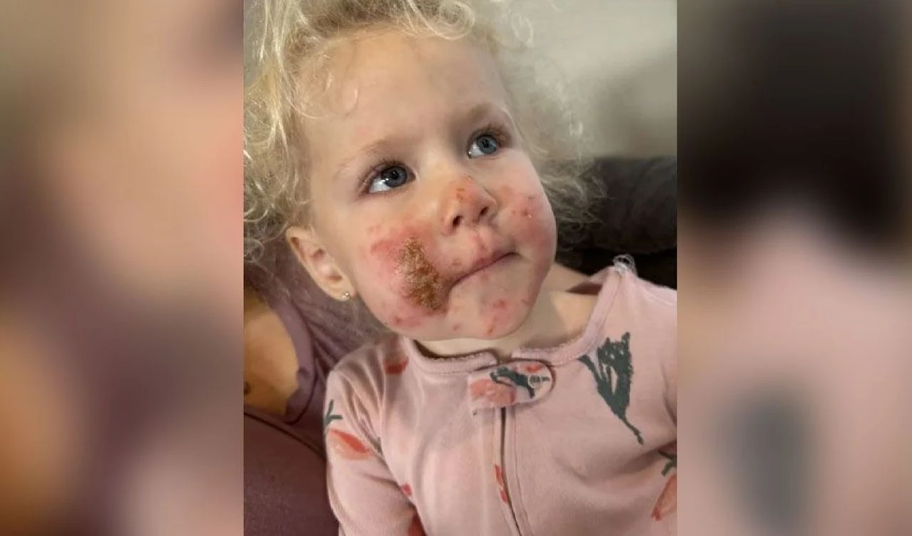 Minik kızın çiçeğe dokunmasıyla vücudunu yaraların sarması bir oldu!