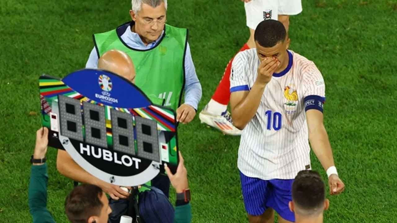 Burnu kırılan Kylian Mbappe Euro 2024&#039;e maske ile devam edecek