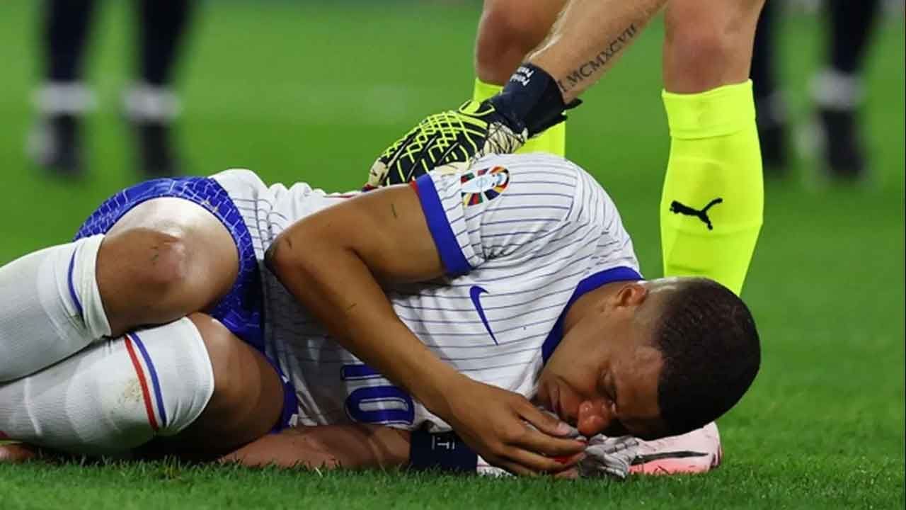 Burnu kırılmıştı... Mbappe Euro 2024&#039;e devam edecek mi?